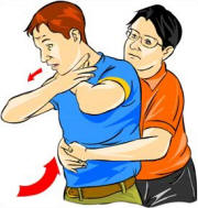 Image result for choking first aid