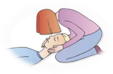 CPR First Aid Head Injury
